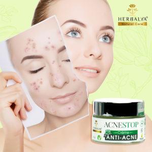 Crème anti acné peaux mixtes, grasse et acnéiques