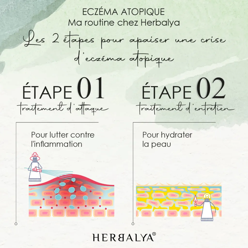 You are currently viewing Eczema: quel traitement naturel adopter ?