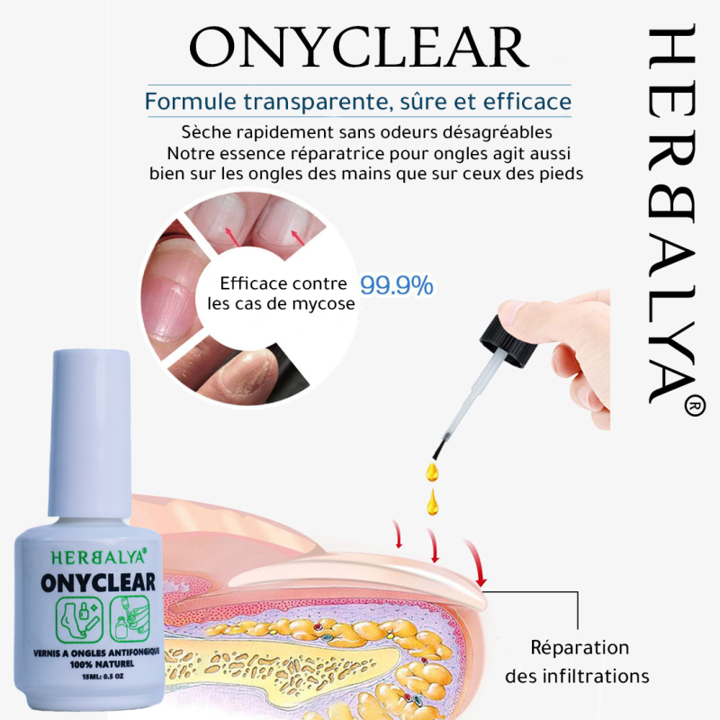 onyclear vernis ongles antimycosique