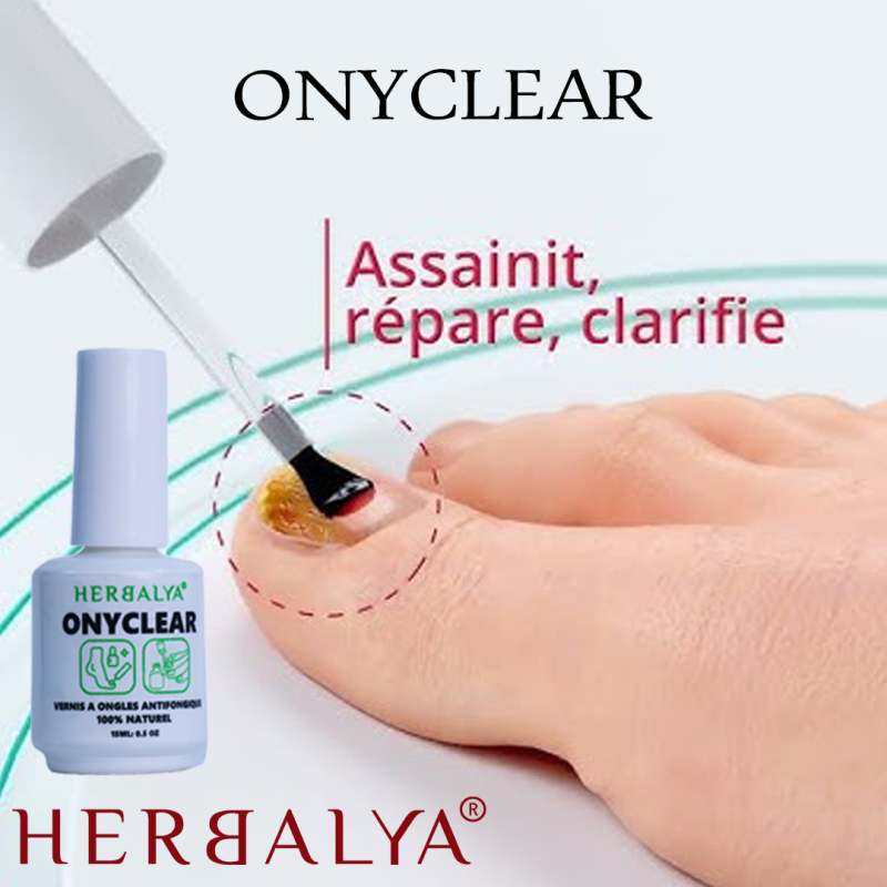 onyclear vernis ongles antimycosique