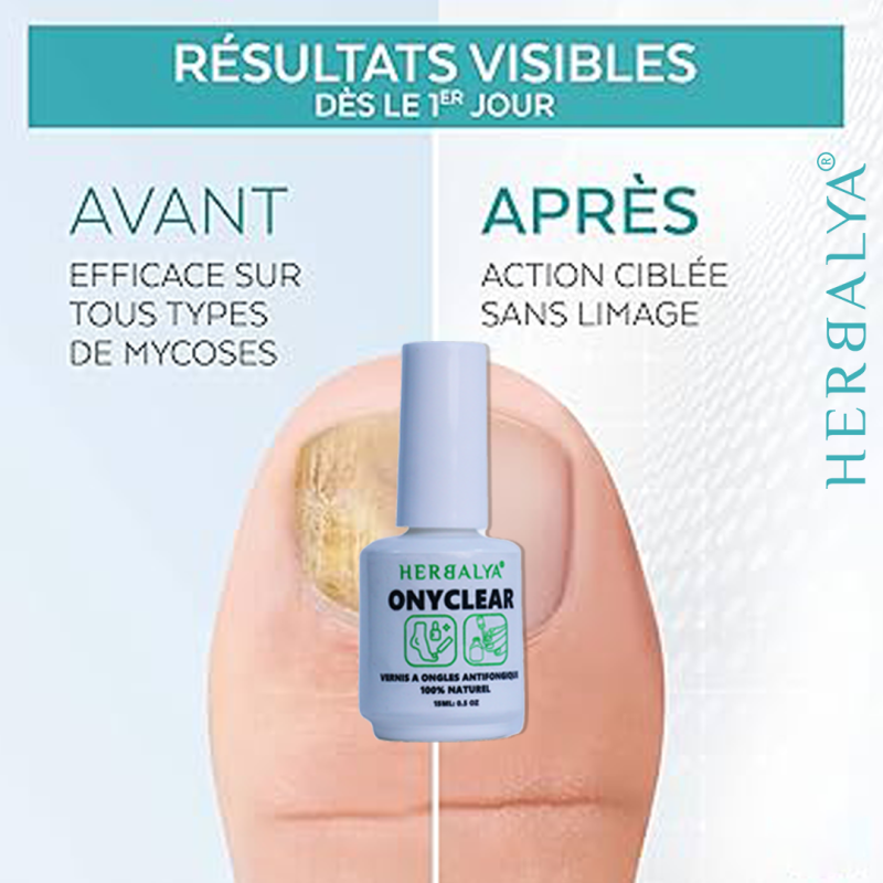 OnyClear PACK deux vernis ongles antimycosique – Image 4