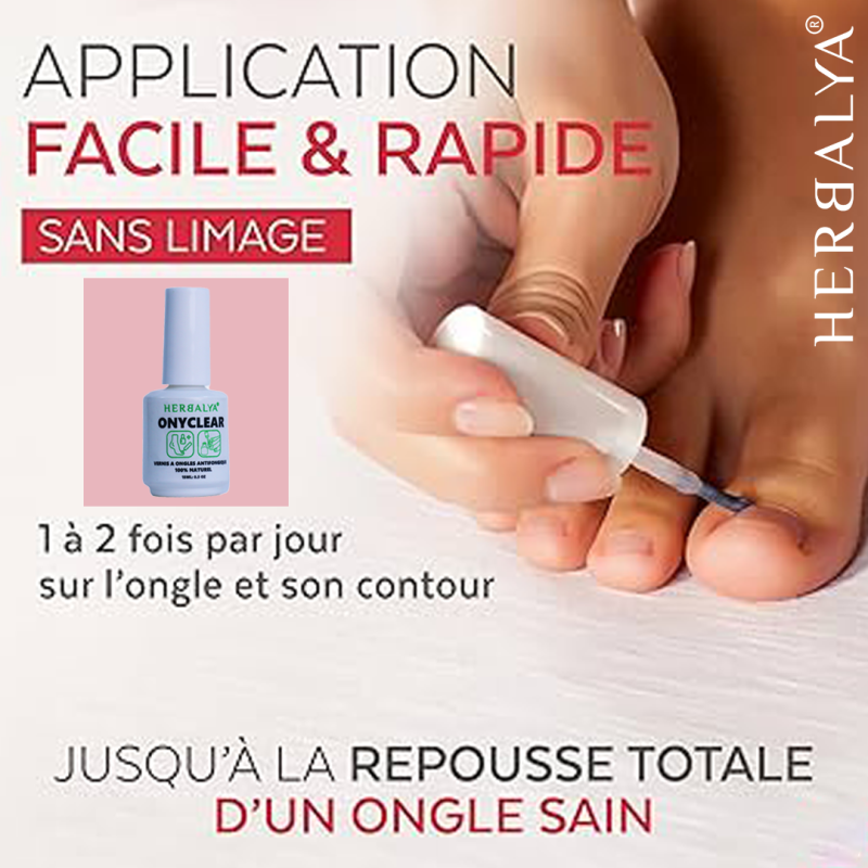 OnyClear PACK deux vernis ongles antimycosique – Image 3